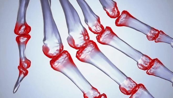 Pain in the joints of fingers